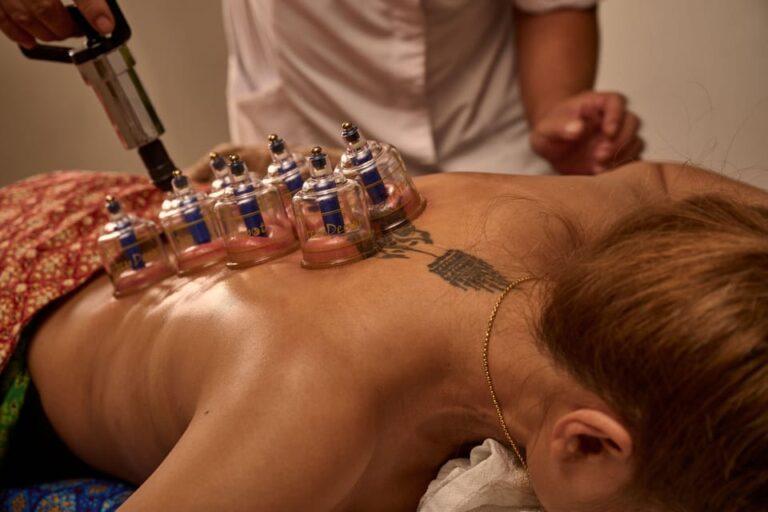 Cupping Therapy What Is Cupping Therapy?